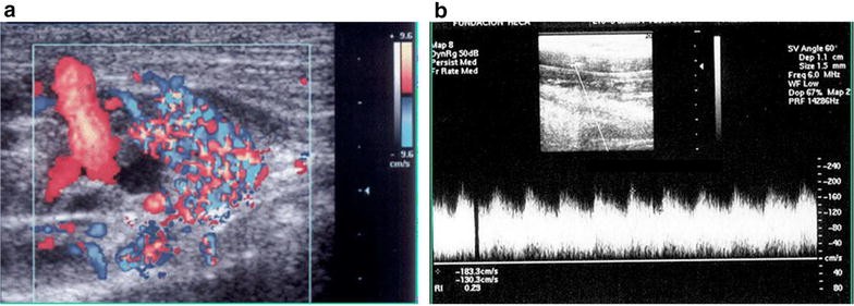 Fig. 17