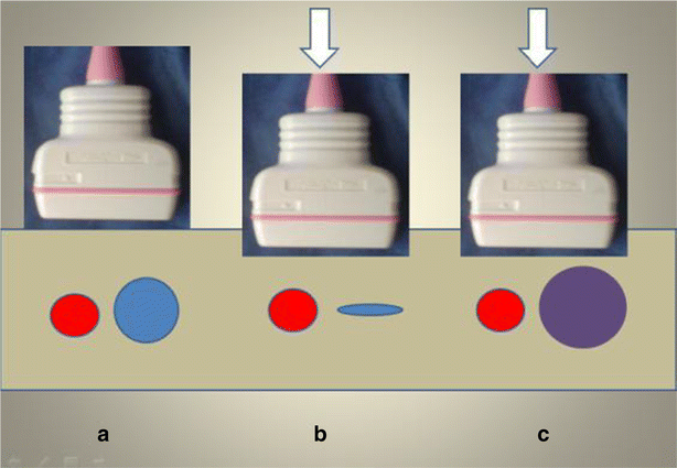 Fig. 6