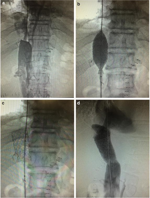 Fig. 1