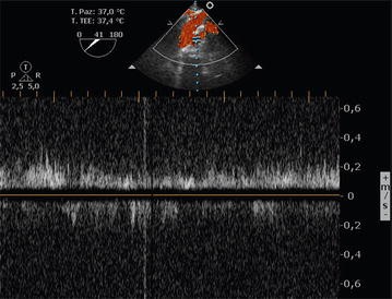 Fig. 4