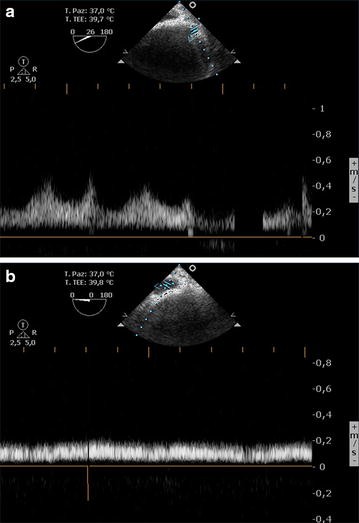 Fig. 6