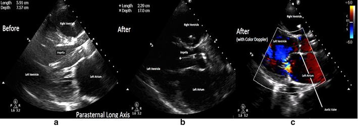 Fig. 2