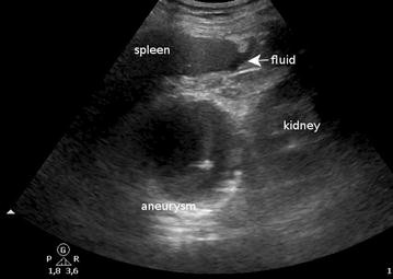 Fig. 1