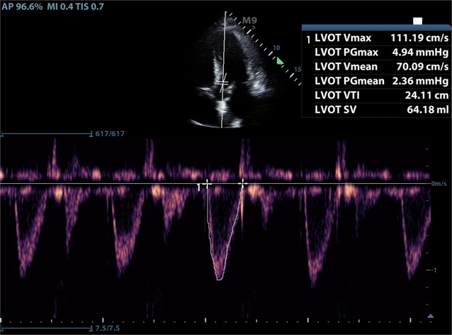 Fig. 2