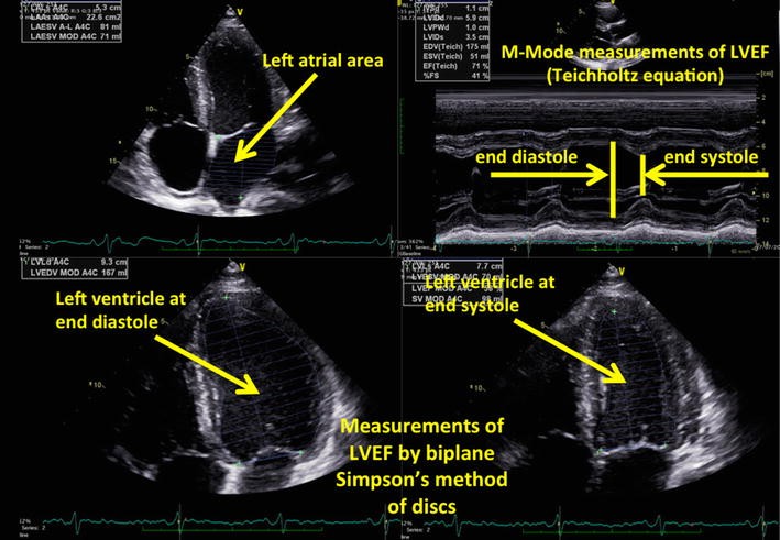 Fig. 2