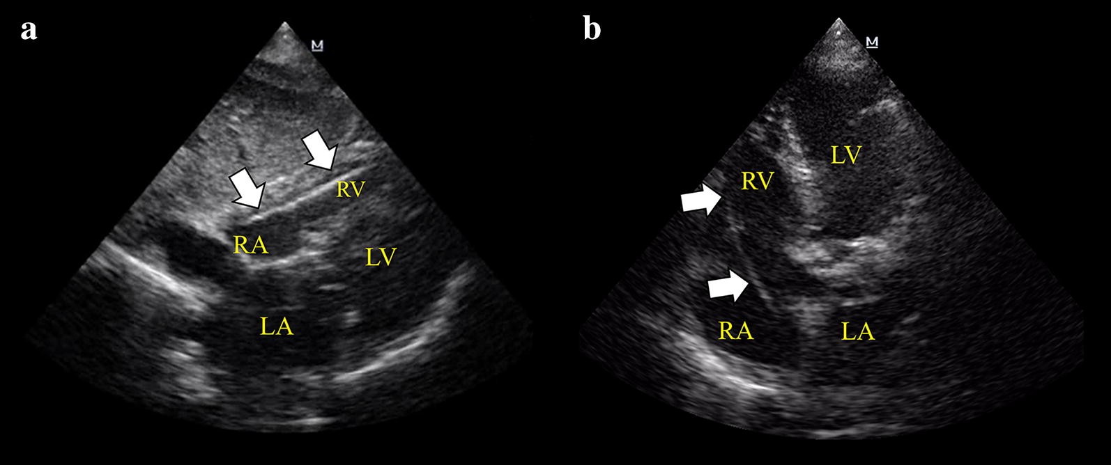 Fig. 1