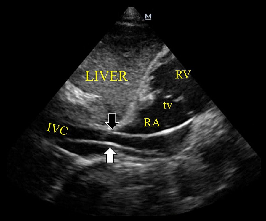 Fig. 2