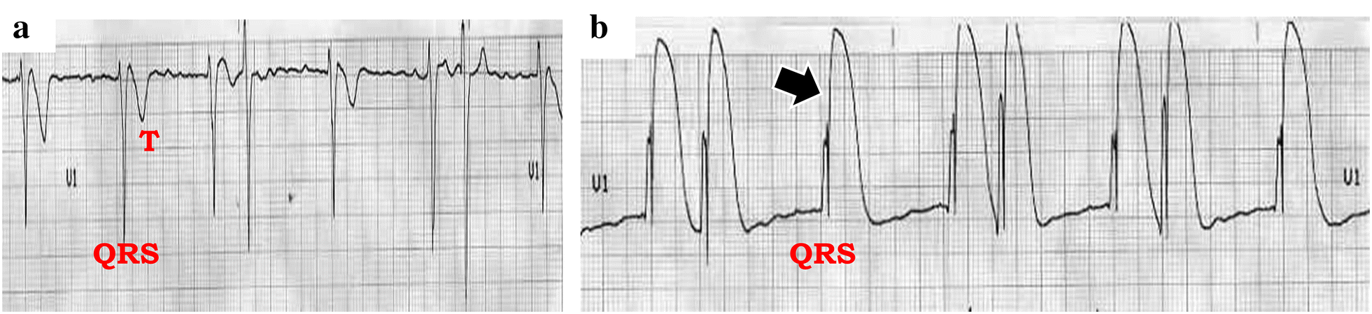 Fig. 4