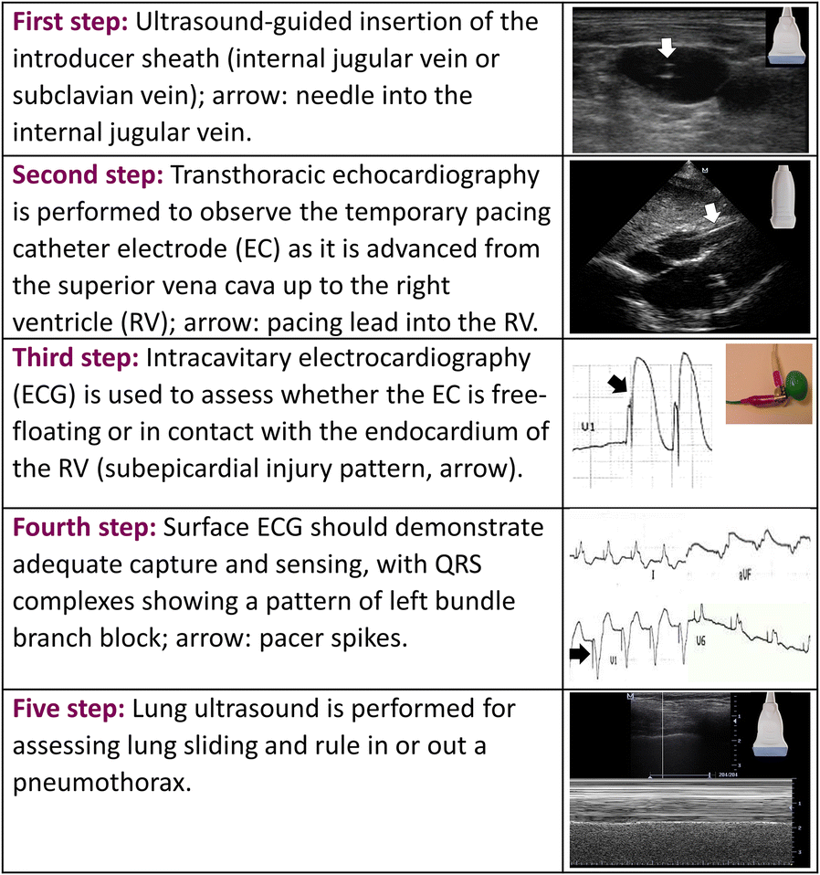 Fig. 6