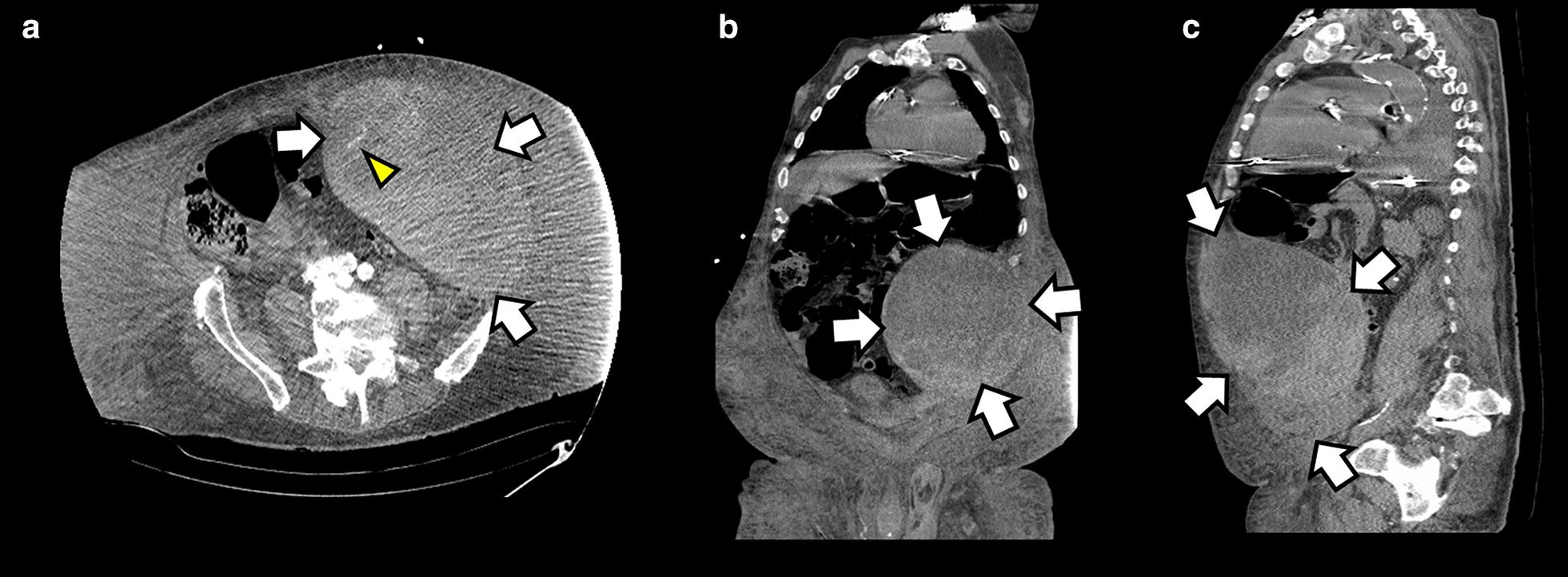 Fig. 2