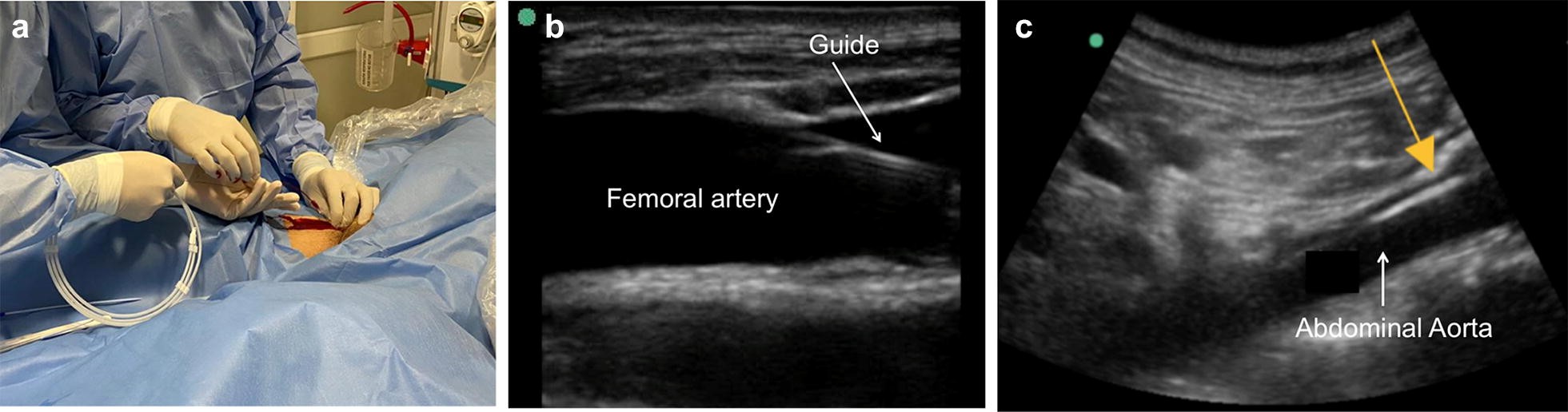 Fig. 3