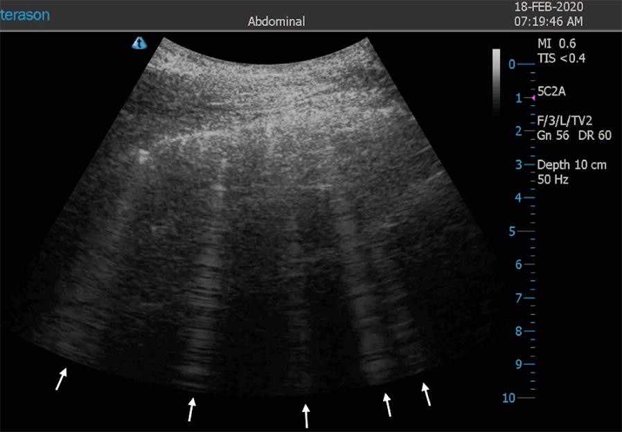 Fig. 4