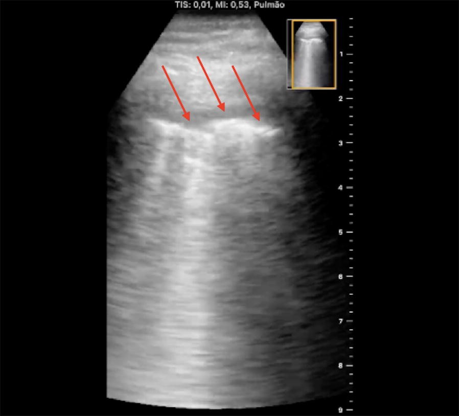 Fig. 7