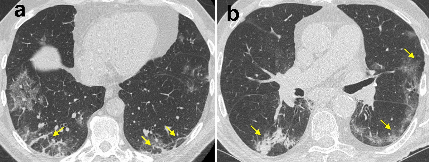 Fig. 10