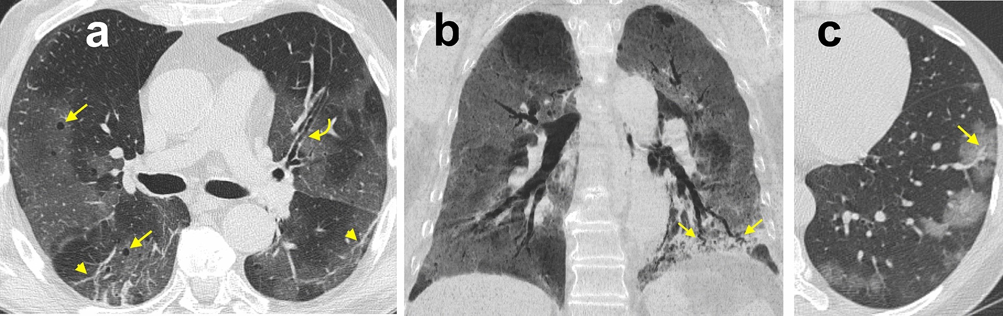 Fig. 11