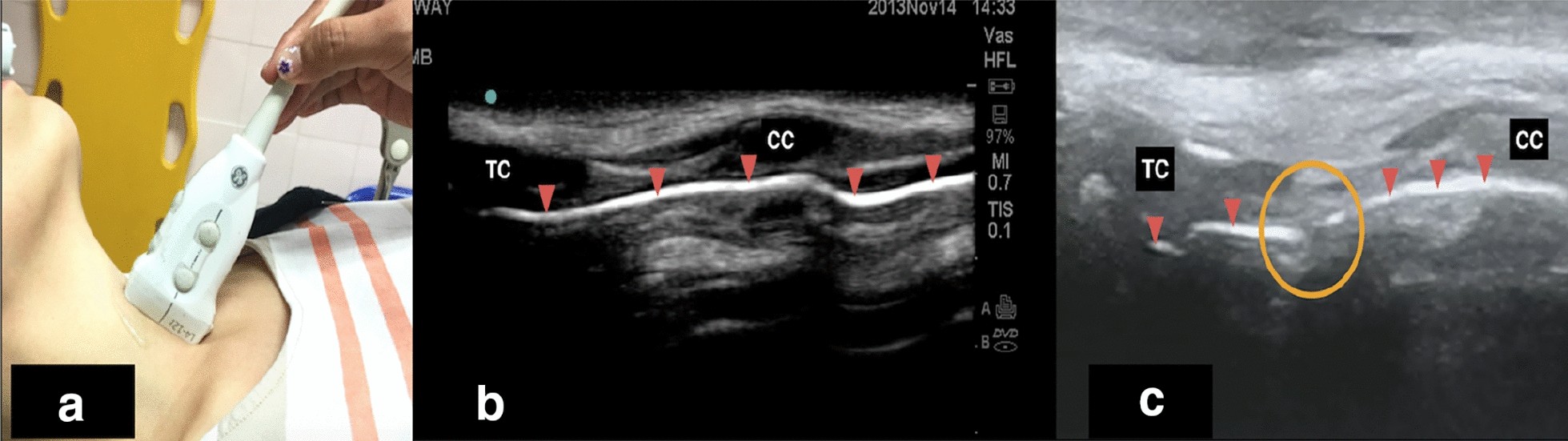 Fig. 1