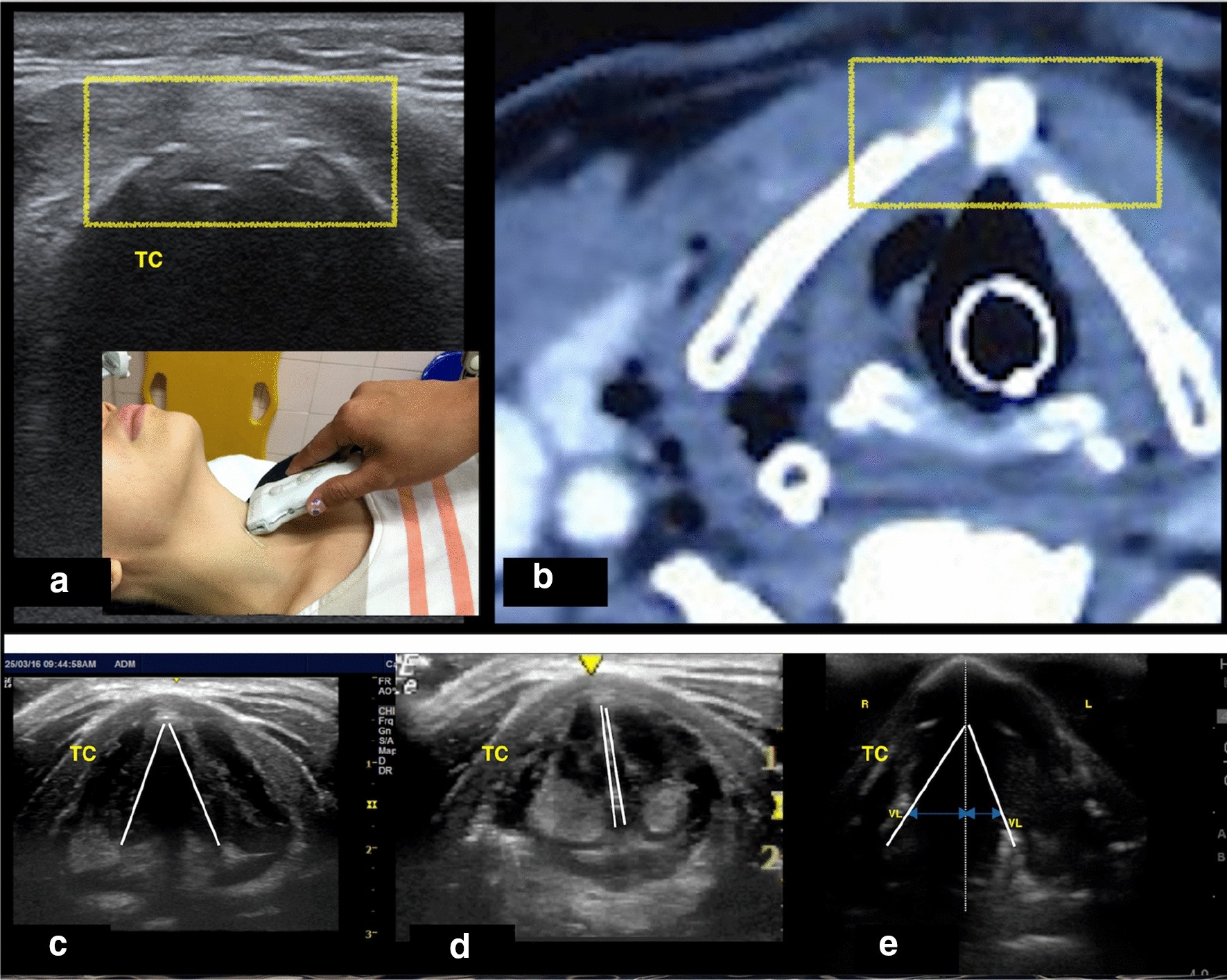 Fig. 3