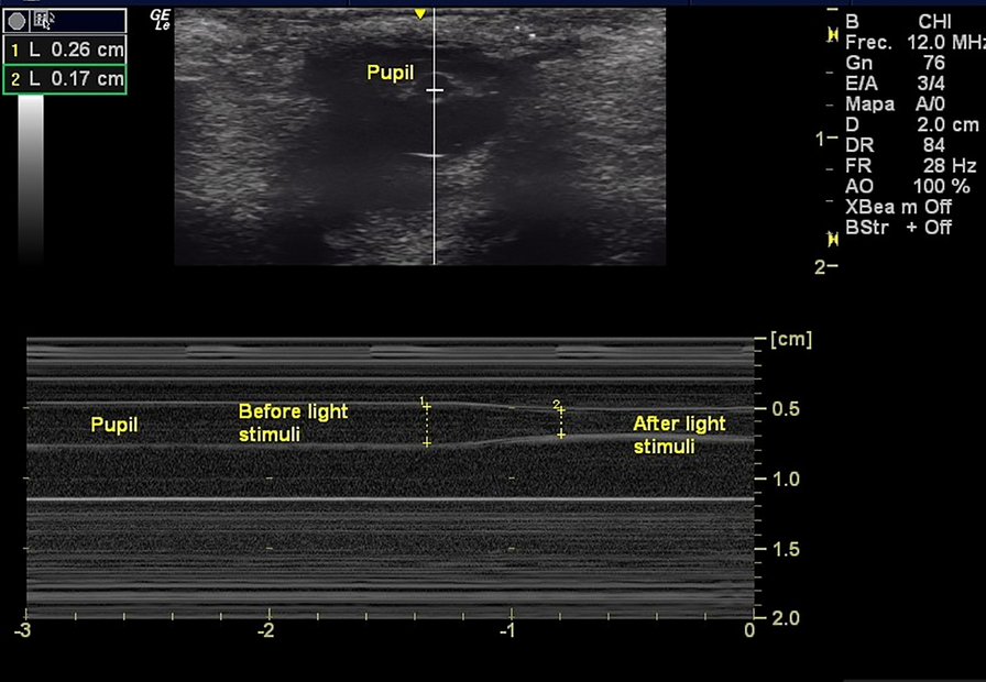 Fig. 2