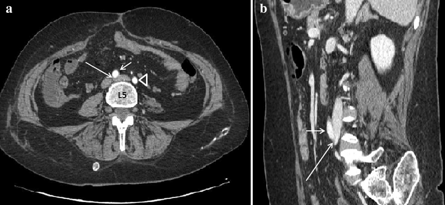 Fig. 13