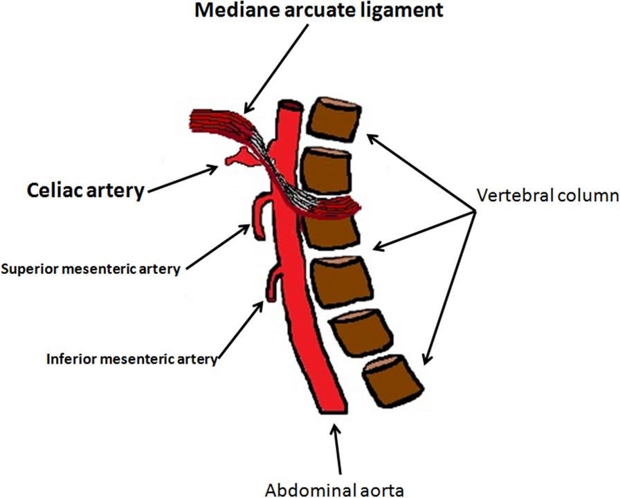 Fig. 15