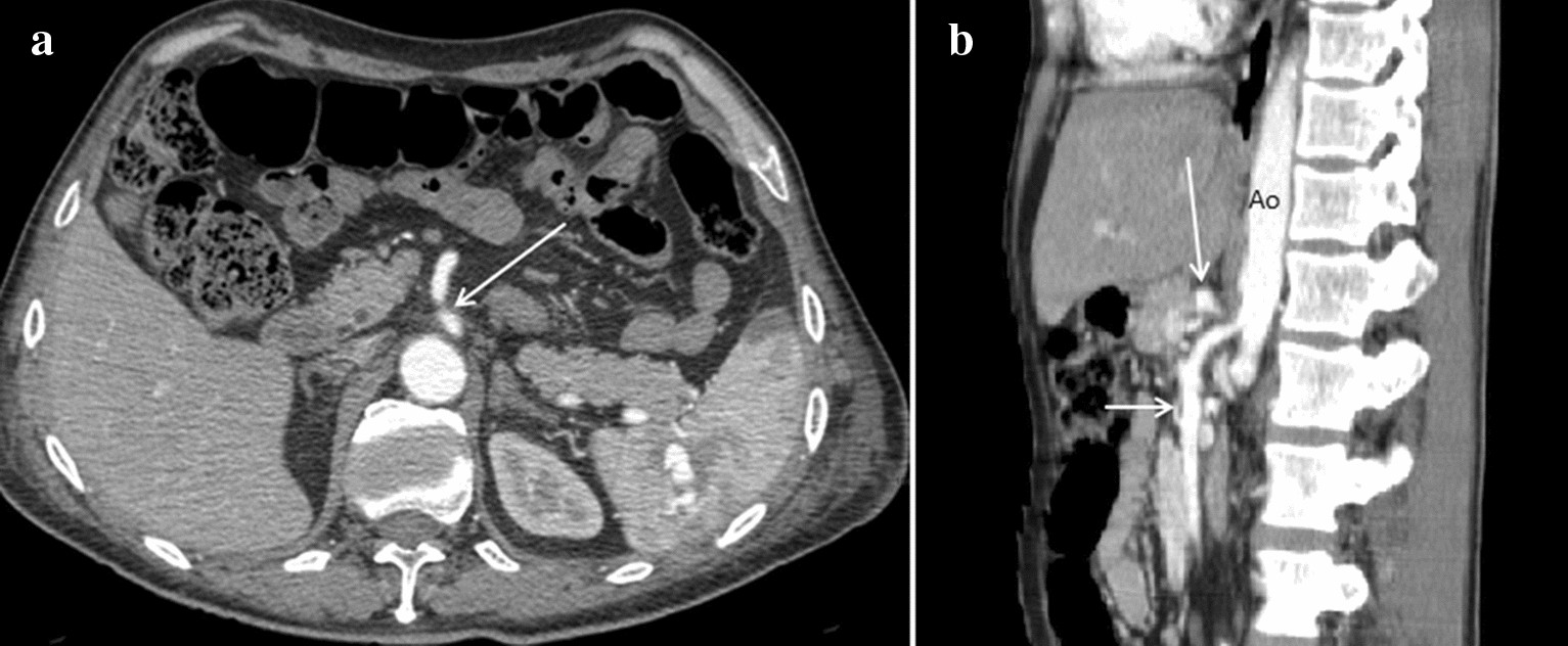 Fig. 17