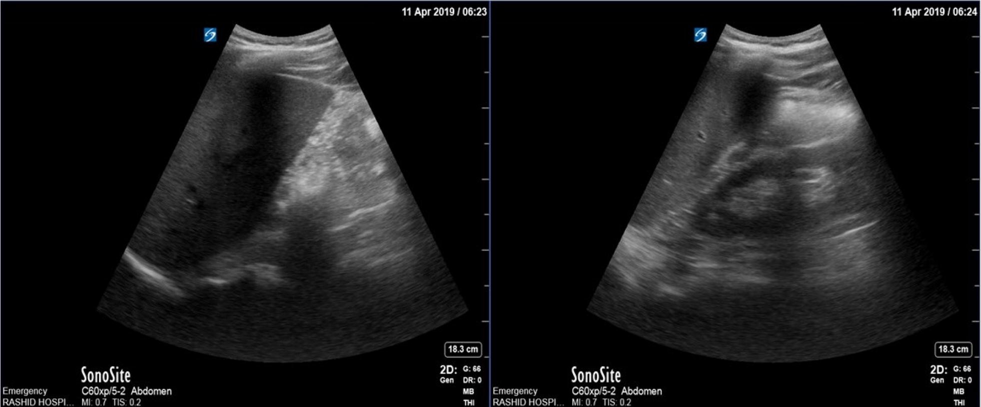 Fig. 1