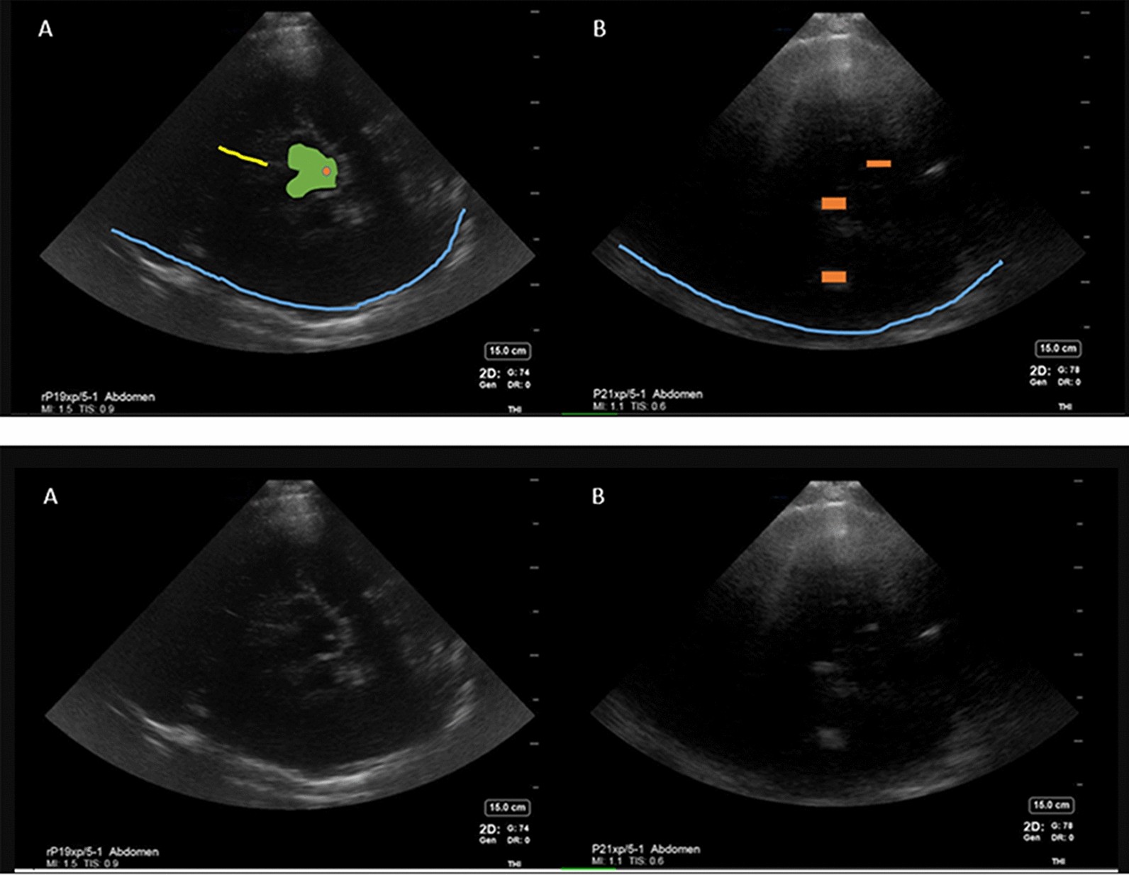 Fig. 2