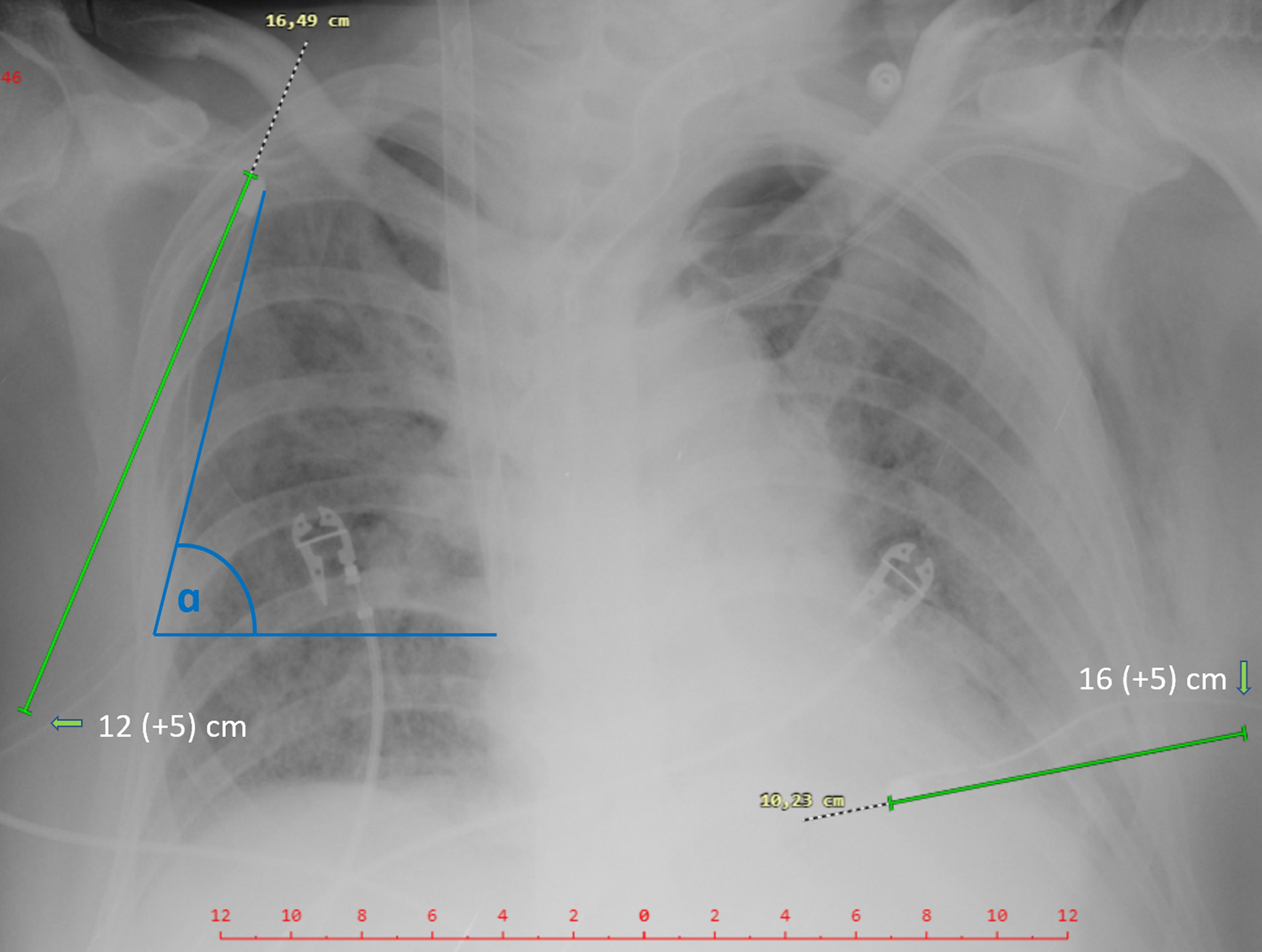 Fig.2