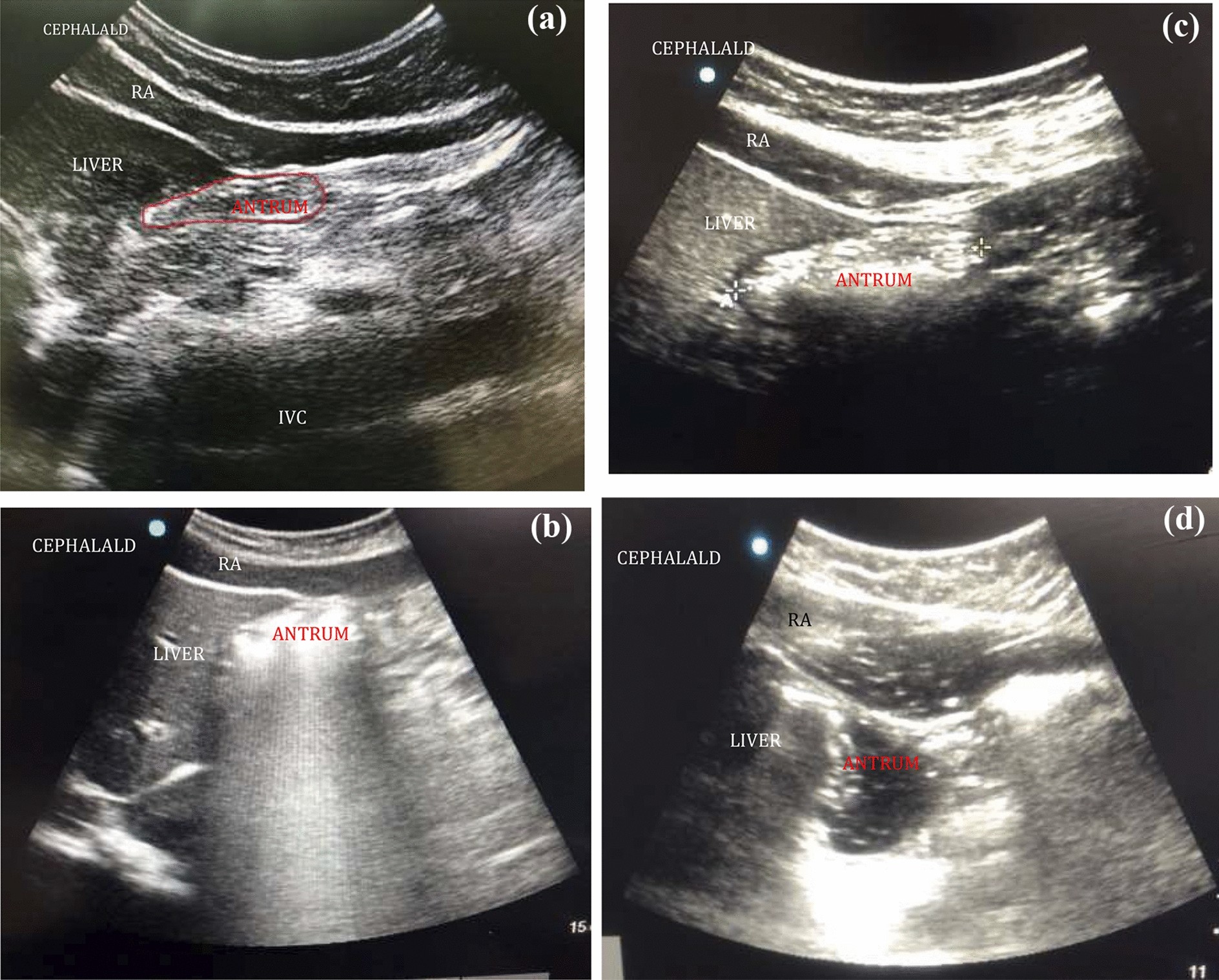 Fig. 2