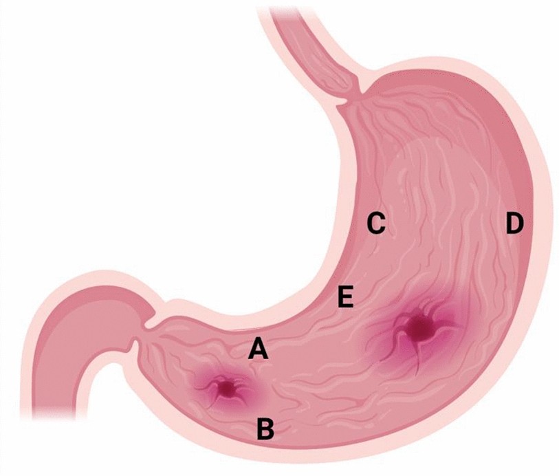 Fig. 4