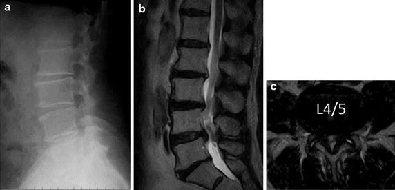 Fig. 1