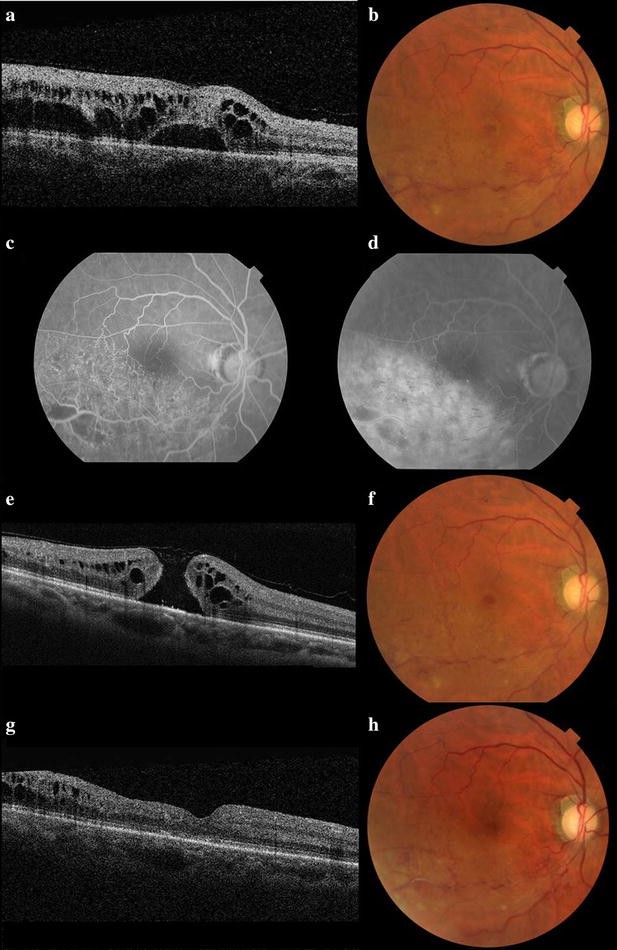 Fig. 1