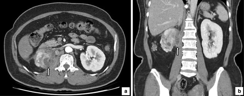 Fig. 1