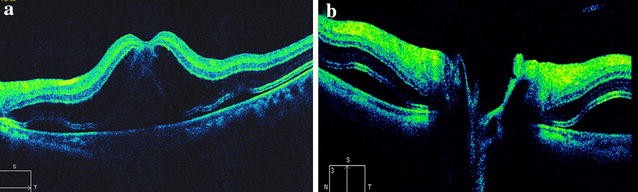 Fig. 1