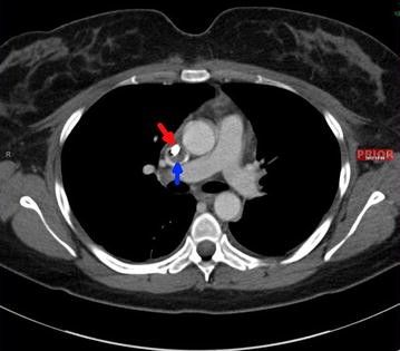 Fig. 1