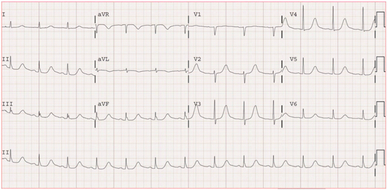 Fig. 1