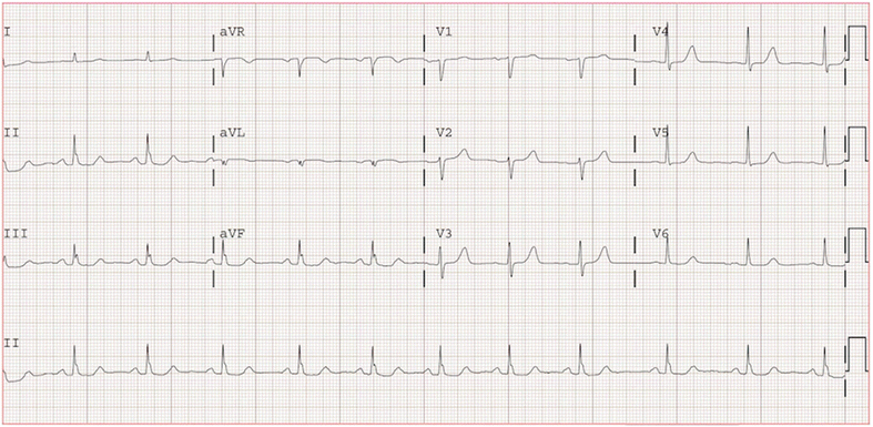 Fig. 2