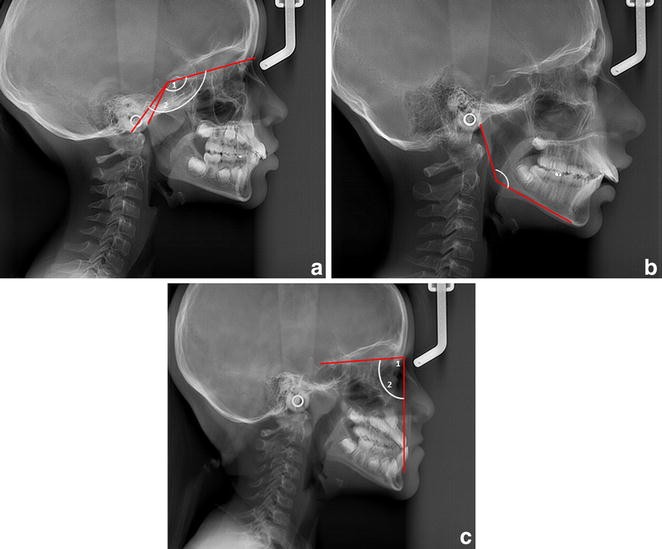 Fig. 2