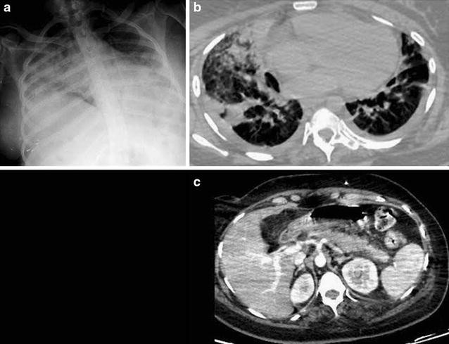 Fig. 1