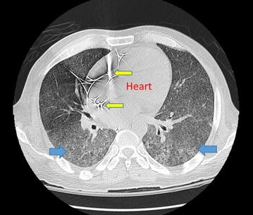 Fig. 2