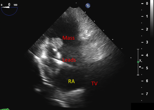 Fig. 3