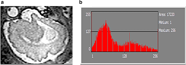 Fig. 4