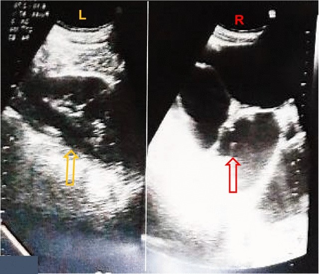 Fig. 1