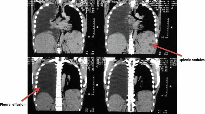 Fig. 2