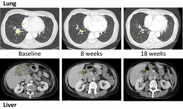 Fig. 1