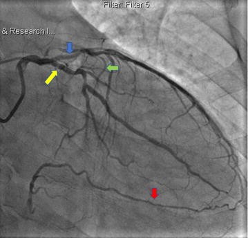 Fig. 1