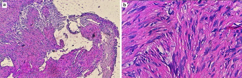 Fig. 2