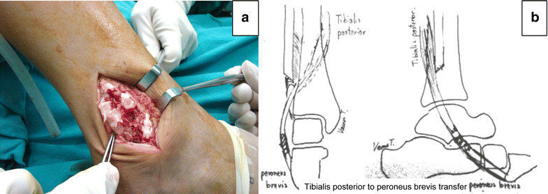 Fig. 3