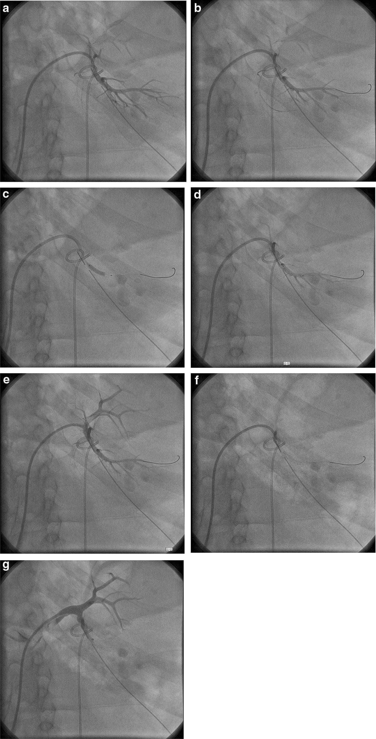 Fig. 2