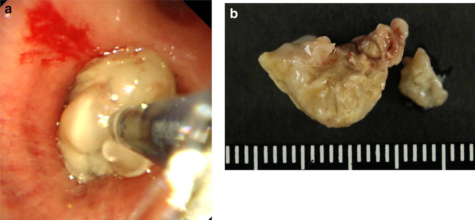 Fig. 3